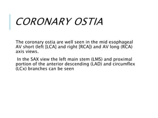 CORONARY OSTIA
The coronary ostia are well seen in the mid esophageal
AV short (left [LCA] and right [RCA]) and AV long (RCA)
axis views.
In the SAX view the left main stem (LMS) and proximal
portion of the anterior descending (LAD) and circumflex
(LCx) branches can be seen
 