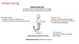 Initial swing
Uneven heel rise
Prosthetic heel rises quite markedly and rapidly
when knee is flexed at beginning of swing phase
Prosthetic causes:
– Insufficient friction in the knee axis
– Insufficient strength of the knee extension aid
Amputee causes:
– Amputee may be using more power
than necessary to force knee into flexion
– Too fast (uncontrolled) gait
Management:
Adjust knee friction or damping
Gait training
Assessment view: Lateral and dorsal
 