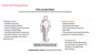 Initial and Swing phase
Pelvic rise (hip hiking)
Excessive pelvic elevation and shoulder to clear foot during swing phase
Prosthetic causes:
– Prosthesis too long
– Excessive plantar flexion
– anterior displacement of the foot
– Incorrect socket fitting
– Insufficient prosthetic suspension
– Excessive friction in the knee axis
– Excessive strength of the knee
extension aid
Amputee causes:
– Weak hip flexors
– Weak internal rotators
– Fear of touching the ground
– Bad habit
– The amputee may have donned the
prosthesis in external rotation.
Management :
Prosthetic hieght Adjustment
Ensure Proper suspension Fit
Hip flexor strengthening
Gait training
Assessment view: Dorsal (and frontal)
 