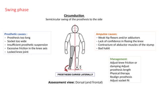 Swing phase
Circumduction
Semicircular swing of the prosthesis to the side
Prosthetic causes :
– Prosthesis too long
– Socket too wide
– Insufficient prosthetic suspension
– Excessive friction in the knee axis
– Locked knee joint
Amputee causes:
– Weak hip flexors and/or adductors
– Lack of confidence in flexing the knee
– Contracture of abductor muscles of the stump
– Bad habit
Management:
Adjust knee friction or
damping Adjust
prosthesis length
Physical therapy
Realign prosthesis
Adjust socket fit
Assessment view: Dorsal (and frontal)
 