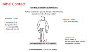 Initial Contact
Rotation of the foot at heel strike
As heel contacts the ground, the foot rotates laterally,
sometimes with vibrating motion
Prosthetic causes:
– Prosthetic foot
bumper too firm
– Loose socket fit
– Too much toe out
Amputee causes:
– poor muscle control
Management:
Adjust socket fit
add belt for rotation control
Reduce heel stiffness
Assessment view: Frontal (and dorsal)
 