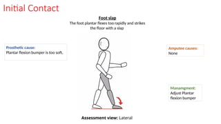 Initial Contact
Foot slap
The foot plantar flexes too rapidly and strikes
the floor with a slap
Prosthetic cause:
Plantar flexion bumper is too soft,
Amputee causes:
None
Manamgment:
Adjust Plantar
flexion bumper
Assessment view: Lateral
 