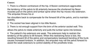 Causes:
1. There is a flexion contracture of the hip. A flexion contracture aggravates
the tendency of the pelvis to tilt anteriorly because the shortened hip flexor
muscles pull on the pelvis and lumbar spine when the hip moves into extension.
The amputee throws his or
her shoulders back to compensate for the forward tilt of the pelvis, and to maintain
stability.
2. The socket has been aligned in too little flexion.
3. There is not enough support from the brim of the anterior socket wall. This
allows the pelvis to rotate anteriorly and pulls the lumbar spine into lordosis.
4. The patient’s hip extensors are weak. The extensors help to restrain the
tendency of the pelvis to tilt forward. When this restraining force is lost, the
resulting forward tilt of the pelvis and compensatory backward bending of the trunk
causes increased lordosis. In addition, the amputee may roll the pelvis forward to
assist the weak extensors to control stability of the prosthetic knee.
 