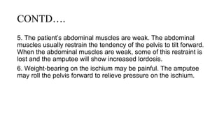 CONTD….
5. The patient’s abdominal muscles are weak. The abdominal
muscles usually restrain the tendency of the pelvis to tilt forward.
When the abdominal muscles are weak, some of this restraint is
lost and the amputee will show increased lordosis.
6. Weight-bearing on the ischium may be painful. The amputee
may roll the pelvis forward to relieve pressure on the ischium.
 