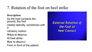 7. Rotation of the foot on heel strike
Description:
As the heel contacts the
ground, the foot
rotates laterally, sometimes with
a
vibratory motion.
When to observe:
At heel strike
How to observe:
From in front of the patient
 