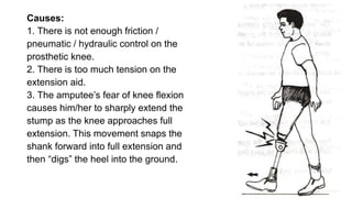 Causes:
1. There is not enough friction /
pneumatic / hydraulic control on the
prosthetic knee.
2. There is too much tension on the
extension aid.
3. The amputee’s fear of knee flexion
causes him/her to sharply extend the
stump as the knee approaches full
extension. This movement snaps the
shank forward into full extension and
then “digs” the heel into the ground.
 