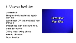 9. Uneven heel rise
Description:
The prosthetic heel rises higher
than the
sound heel, OR the prosthetic heel
shows a
smaller rise than the sound heel.
When to observe:
During initial swing phase
How to observe:
From the side
 