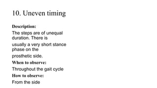 10. Uneven timing
Description:
The steps are of unequal
duration. There is
usually a very short stance
phase on the
prosthetic side.
When to observe:
Throughout the gait cycle
How to observe:
From the side
 
