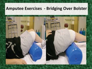 Amputee Exercises - Bridging Over Bolster
 