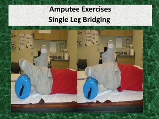 Amputee Exercises
Single Leg Bridging
 