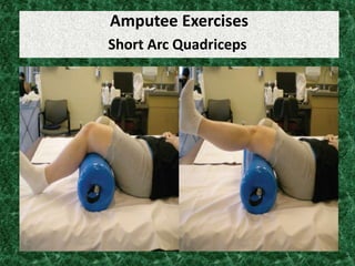 Amputee Exercises
Short Arc Quadriceps
 
