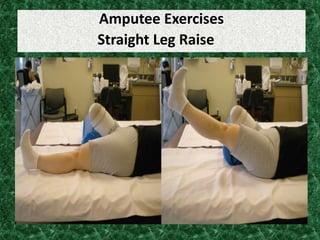 Amputee Exercises
Straight Leg Raise
 