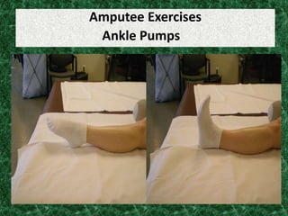 Amputee Exercises
Ankle Pumps
 