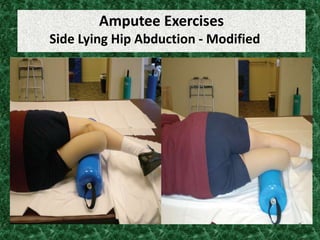 Amputee Exercises
Side Lying Hip Abduction - Modified
 