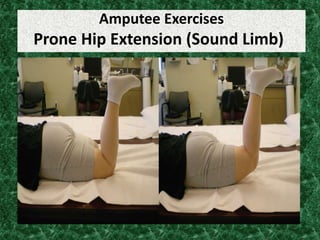 Amputee Exercises
Prone Hip Extension (Sound Limb)
 