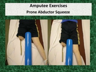 Amputee Exercises
Prone Abductor Squeeze
 