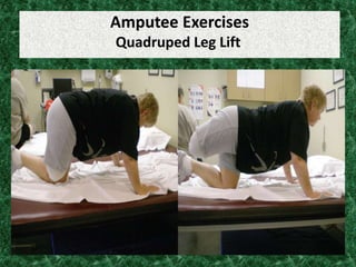 Amputee Exercises
Quadruped Leg Lift
 