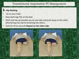 Transfemoral Amputation PT Management
3. Hip Hitching
• Lie on your back.
• Keep both legs flat on the bed.
• Hitch one hip up towards you on one side and push away on the other
(shortening one side & stretching the other).
• Hold for three seconds Repeat on the other side.
 