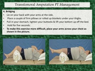 Transfemoral Amputation PT Management
4. Bridging
• Lie on your back with your arms at the side.
• Place a couple of firm pillows or rolled up blankets under your thighs.
• Pull in your stomach, tighten your buttocks & lift your bottom up off the bed.
• Hold for five seconds.
• To make this exercise more difficult, place your arms across your chest as
shown in the picture.
 