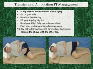 Transfemoral Amputation PT Management
• 5. Hip Flexion and Extension in Side Lying
• Lie on your side.
• Bend the bottom leg.
• Lift your top leg slightly.
• Bend your thigh fully towards your chest.
• Push your leg backwards as far as you can.
NB: Try not to let your hips roll forwards or backwards
Repeat the above with the other leg.
 