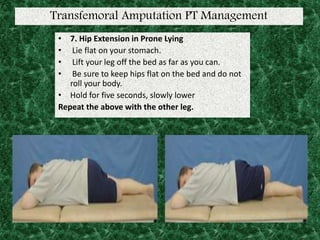 Transfemoral Amputation PT Management
• 7. Hip Extension in Prone Lying
• Lie flat on your stomach.
• Lift your leg off the bed as far as you can.
• Be sure to keep hips flat on the bed and do not
roll your body.
• Hold for five seconds, slowly lower
Repeat the above with the other leg.
 
