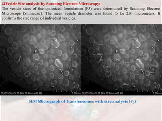 Vesicle Size analysis by Scanning Electron Microscopy:
The vesicle sizes of the optimized formulation (F5) were determined by Scanning Electron
Microscope (Shimadzu). The mean vesicle diameter was found to be 250 micrometers. It
confirms the size range of individual vesicles.
SEM Micrograph of Transfersomes with size analysis (F5)
 