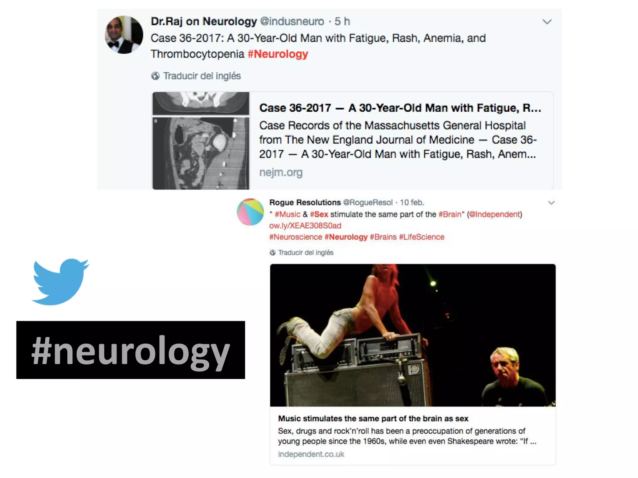 #neurology
 