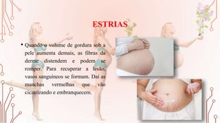 ESTRIAS
• Quando o volume de gordura sob a
pele aumenta demais, as fibras da
derme distendem e podem se
romper. Para recuperar a lesão,
vasos sanguíneos se formam. Daí as
manchas vermelhas que vão
cicatrizando e embranquecem.
 