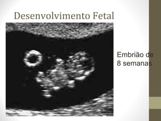 Desenvolvimento Fetal
Embrião de
8 semanas
 