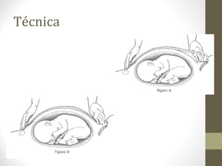 Técnica
 