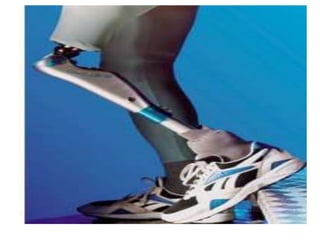 Transformal prothosis | PPTX