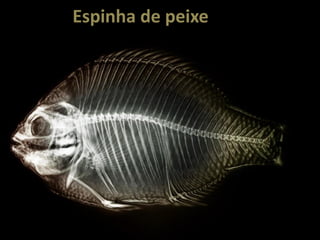Espinha de peixe
 