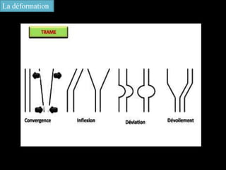 La déformation
 