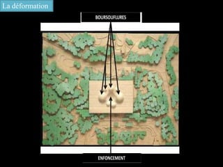 La déformation
 