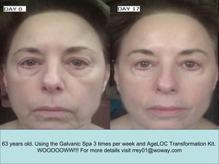 63 years old. Using the Galvanic Spa 3 times per week and AgeLOC Transformation Kit.  WOOOOOWW!!! For more details visit rrey01@woway.com 