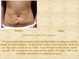 Before                                     After
                   Client had a total of 45 sessions

 “I was considering a tummy tuck and lipo before reading an article
about Transformations. In just three weeks, I have lost four inches in
 my hips and an inch in my waist. I am already feeling better about
 myself. The treatments are easy and the staff is friendly. This is an
             excellent alternative to cosmetic surgery.”
 