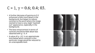 C = 1, γ = 0.6; 0.4; 03.
• A further decrease of gamma to 0.3
enhanced a little more detail in the
background, but began to reduce
contrast to the point where the image
started to have a very slight “washed-
out” appearance, especially in the
background.
• The best enhancement in terms of
contrast and discernible detail was
obtained with g = 0. 4
• A value of g = 0.3 is an approximate
limit below which contrast in this
particular image would be reduced to
an unacceptable level.
 