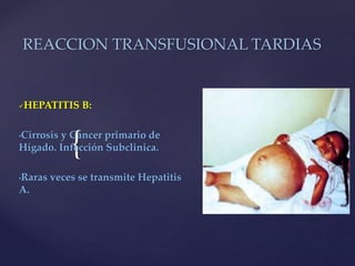 {
REACCION TRANSFUSIONAL TARDIAS
HEPATITIS B:
•Cirrosis y Cáncer primario de
Hígado. Infección Subclinica.
•Raras veces se transmite Hepatitis
A.
 