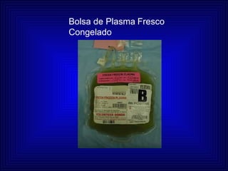 Bolsa de Plasma   Fresco  Congelado 