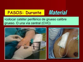octubre 2,012 lic.Esp. Florentina Morales Damián Docente: UNMSM29
•colocar catéter periférico de grueso calibre
grueso. O una vía central (CVC)
PASOS: DurantePASOS: Durante
 
