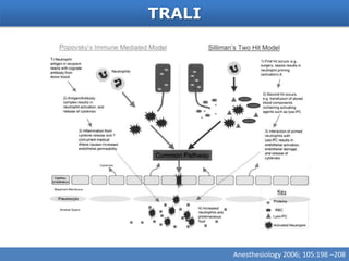 TRALI




        Anesthesiology 2006; 105:198 –208
 