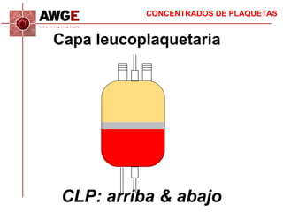 CONCENTRADOS DE PLAQUETAS
Análisis comparativo
Según origen plaquetas
PRP
CLP
individual
CLP
mezcla
Recuperación % 63 ± 18...