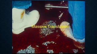 Massive Transfusion
 