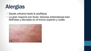 Alergias
• Desde urticaria hasta la anafilaxia
• La gran mayoría son leves: lesiones eritematosas bien
definidas y elevadas en el tronco superior y cuello
 