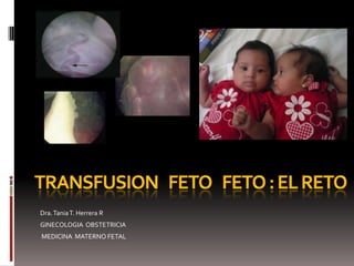     TRANSFUSION   FETO   FETO : el reto   Dra. Tania T. Herrera R GINECOLOGIA  OBSTETRICIA  MEDICINA  MATERNO FETAL 