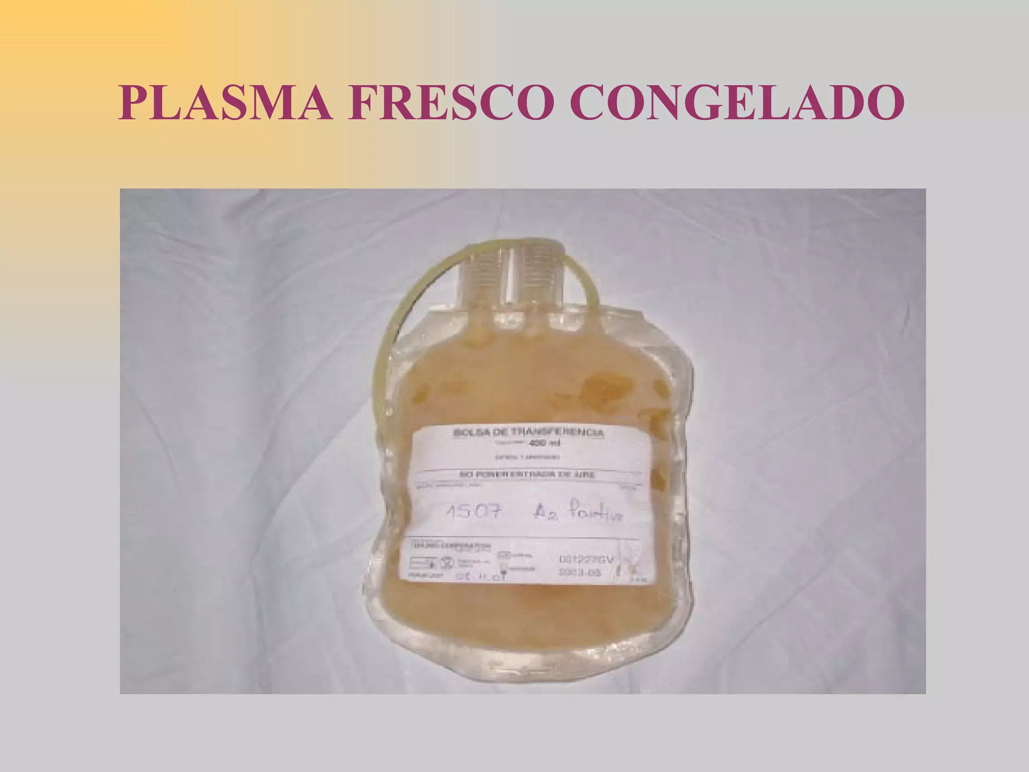 PLASMA FRESCO CONGELADO 