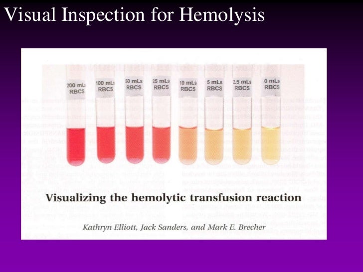 Transfusion Reactions Evaluation & Management