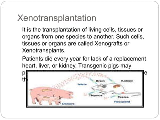 Xenotransplantation
It is the transplantation of living cells, tissues or
organs from one species to another. Such cells,
tissues or organs are called Xenografts or
Xenotransplants.
Patients die every year for lack of a replacement
heart, liver, or kidney. Transgenic pigs may
provide the transplant organs needed to alleviate
the shortfall.
 