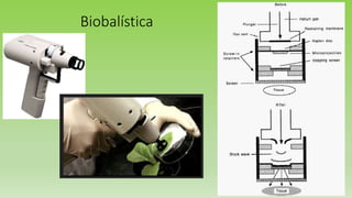 Biobalística
 