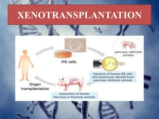 XENOTRANSPLANTATION
 